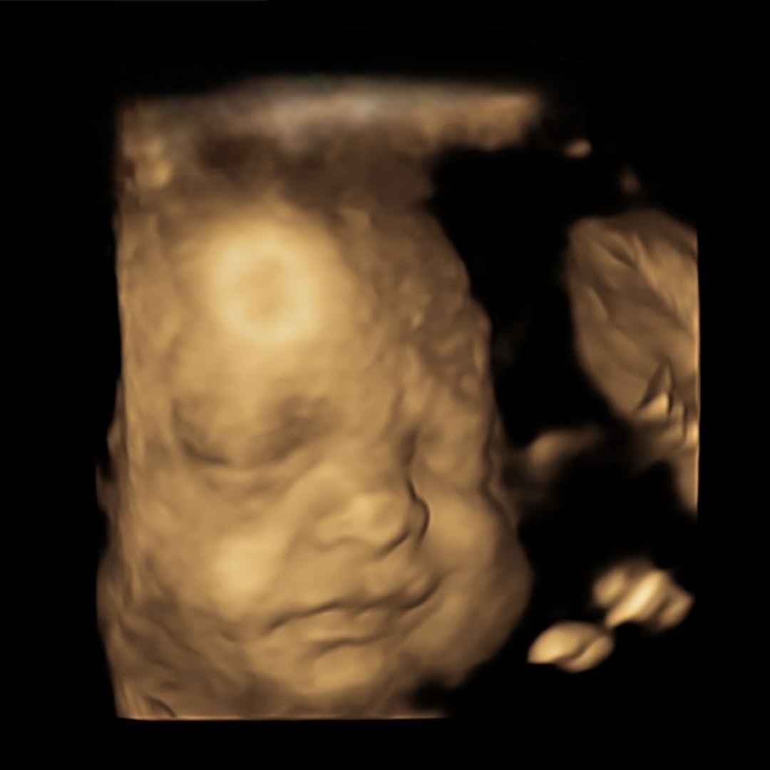 Photo shared by Maria for their Babylist baby registry.