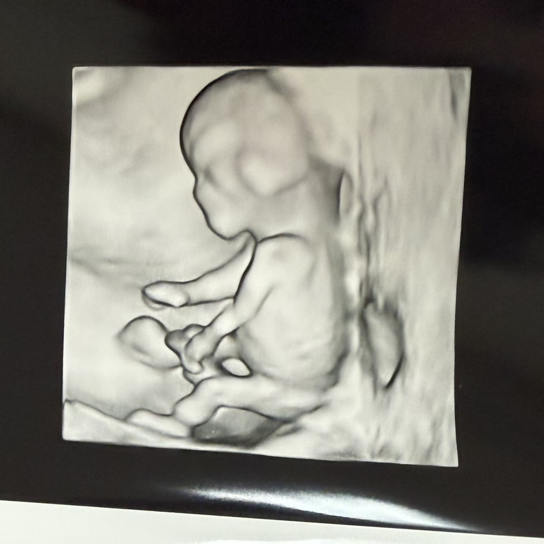 Photo shared by Alyssa for their Babylist baby registry.