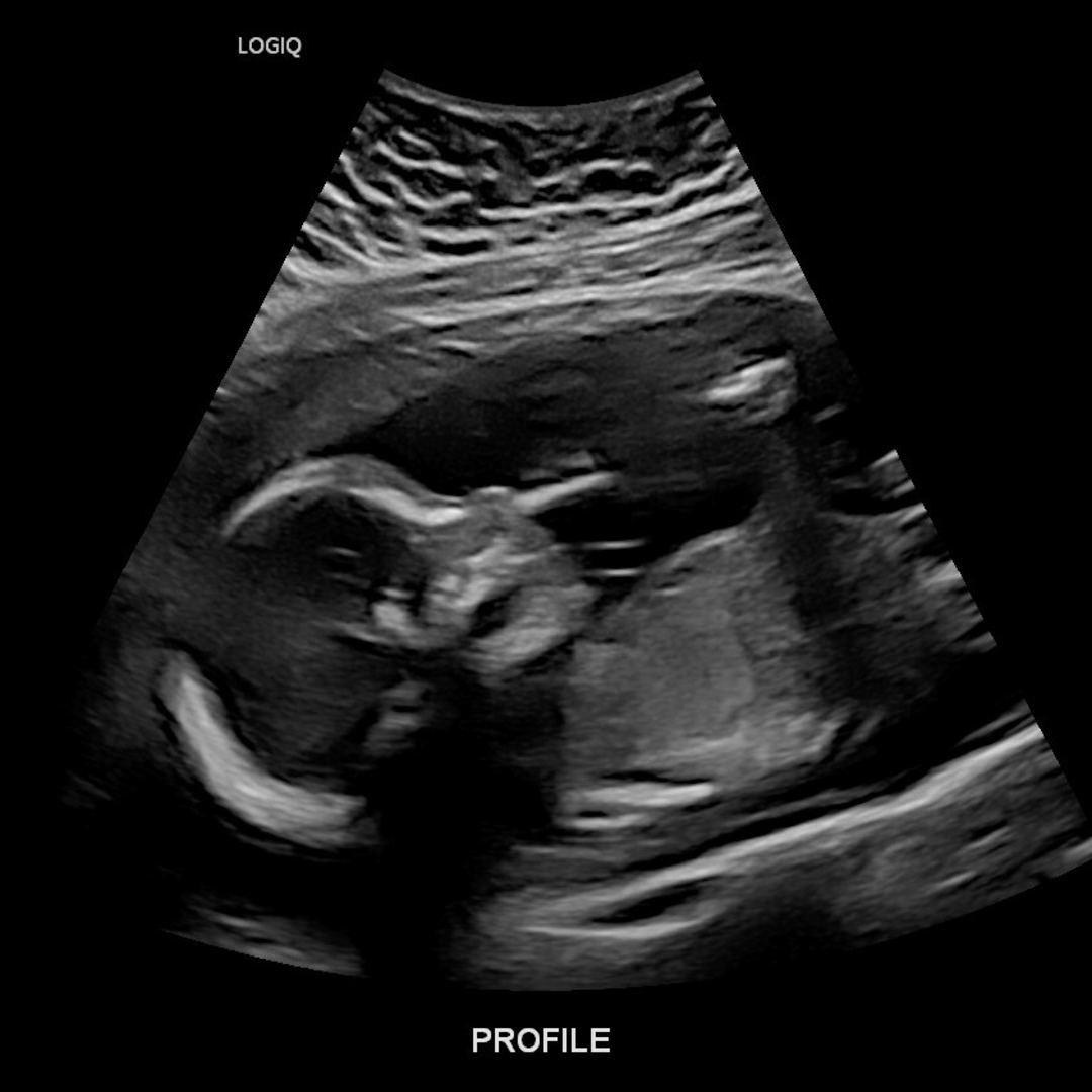 Photo shared by Sierra for their Babylist baby registry.