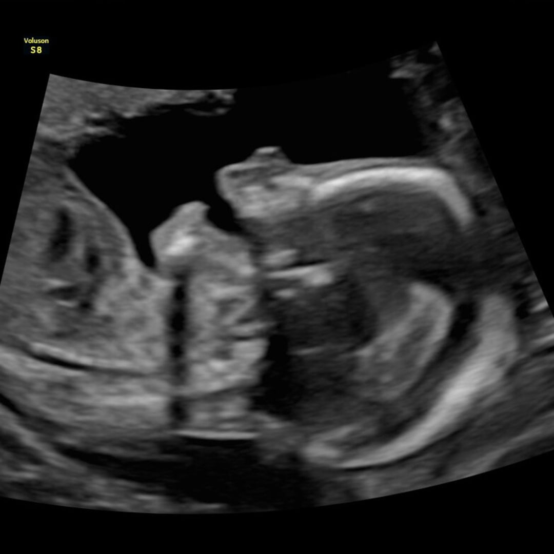 Photo shared by Sandra for their Babylist baby registry.