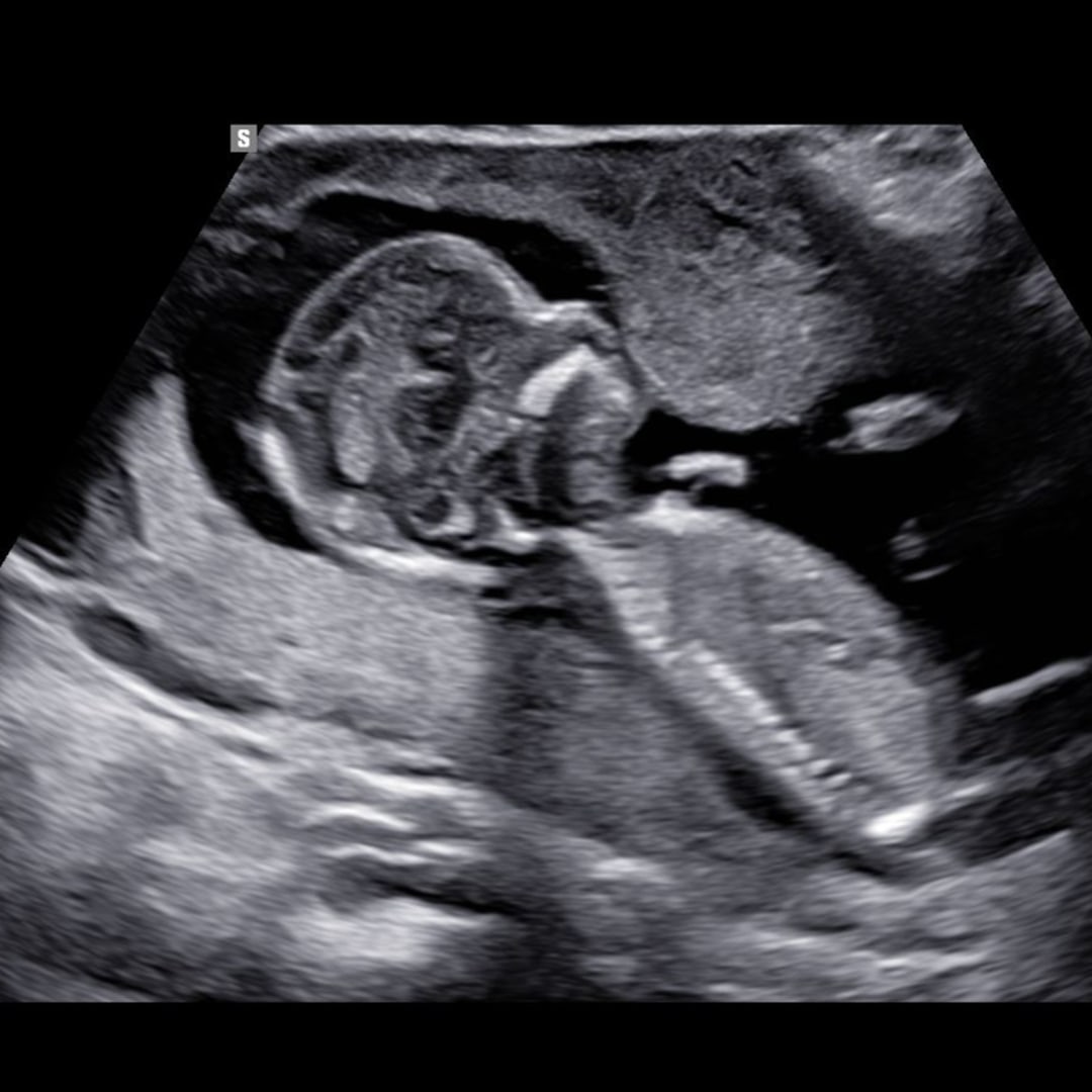 Photo shared by Zoe for their Babylist baby registry.