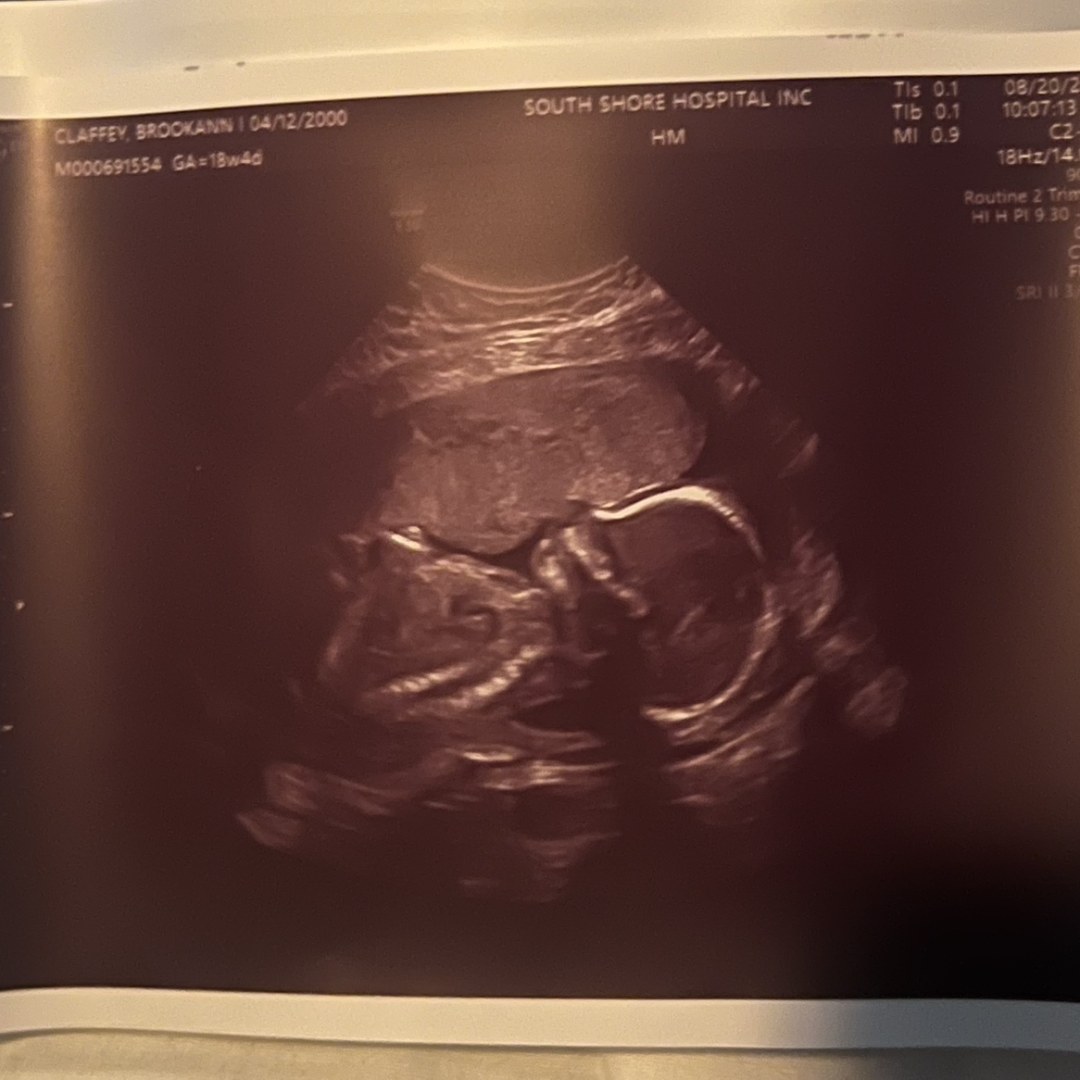 Photo shared by Brookann for their Babylist baby registry.