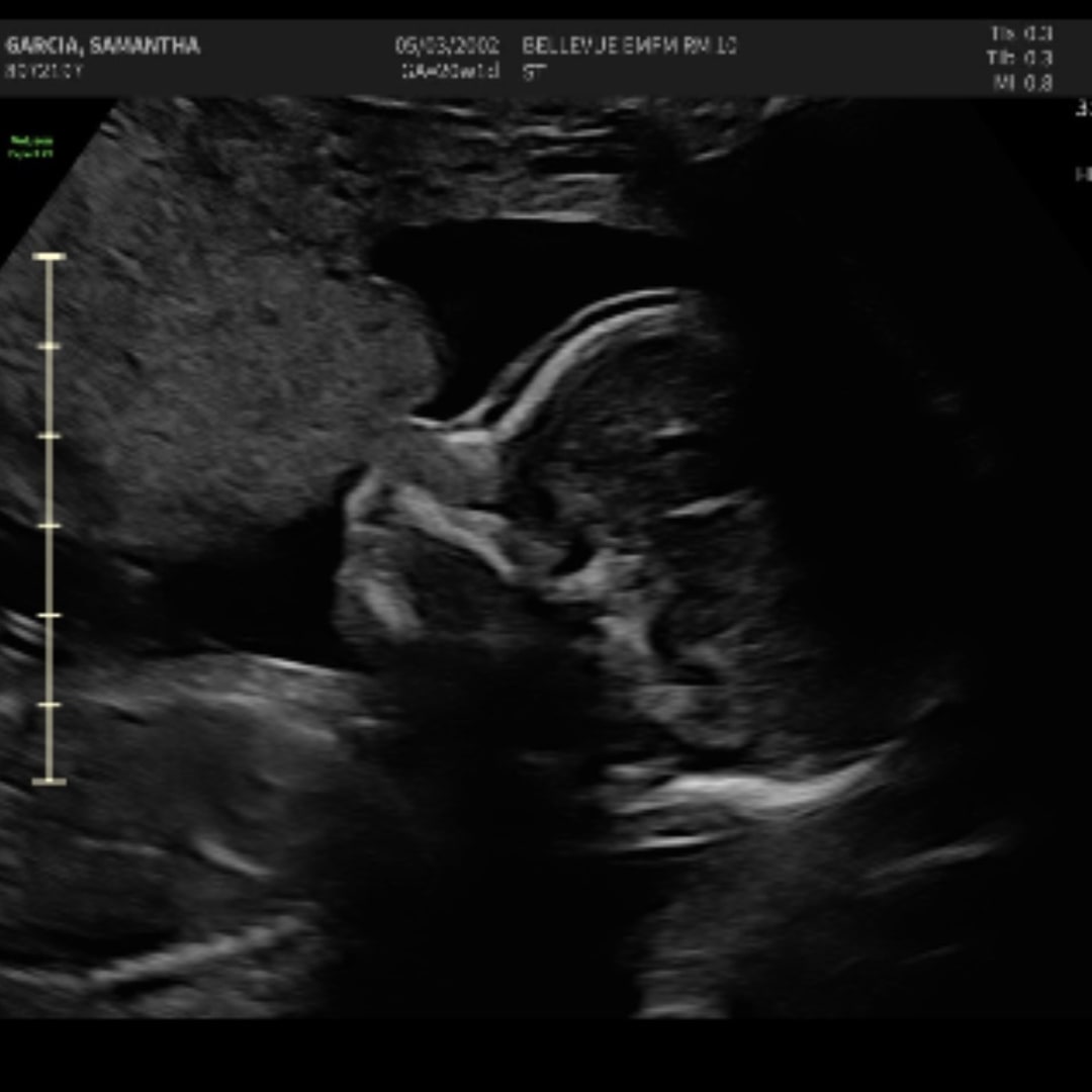 Photo shared by Samantha for their Babylist baby registry.