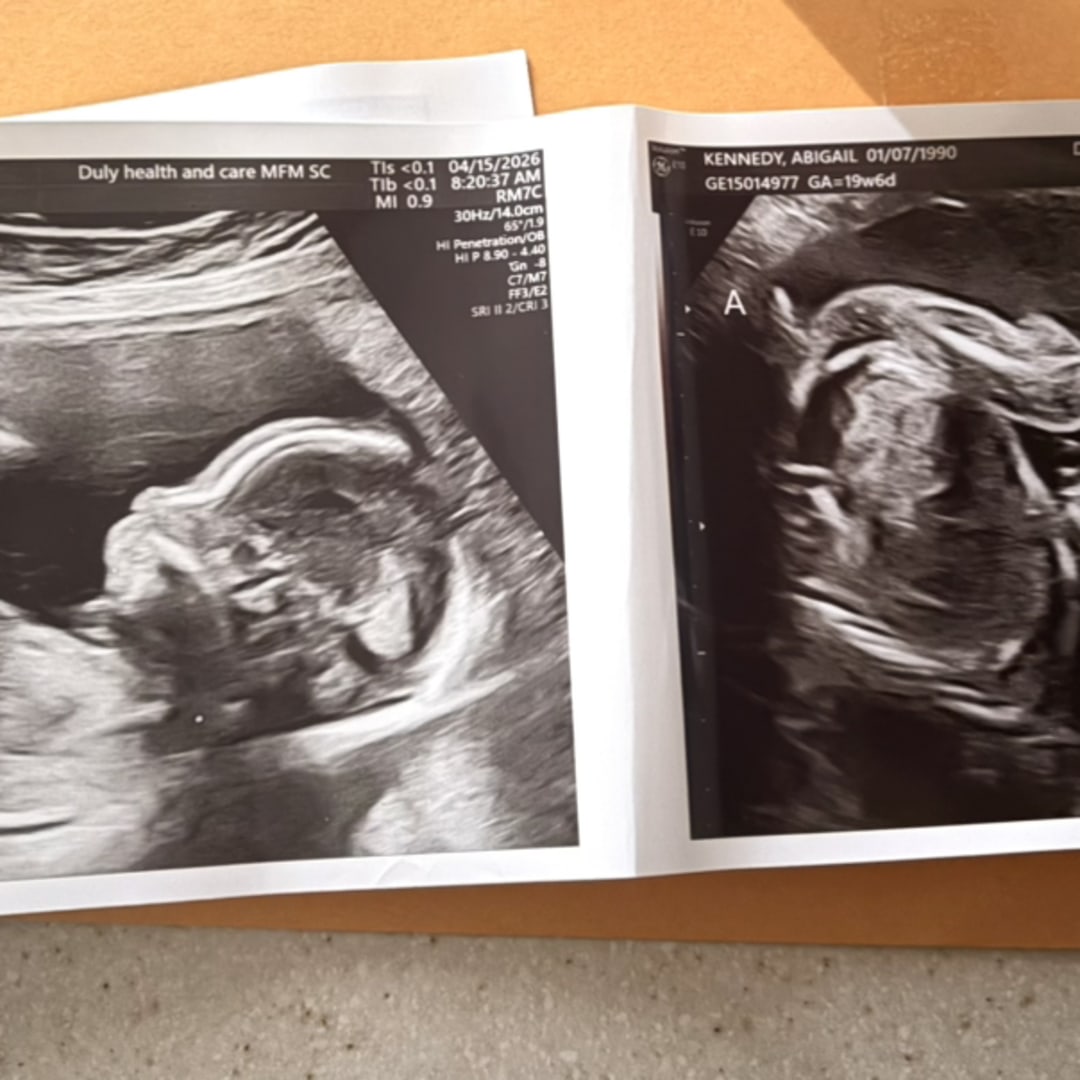 Photo shared by Abbie for their Babylist baby registry.