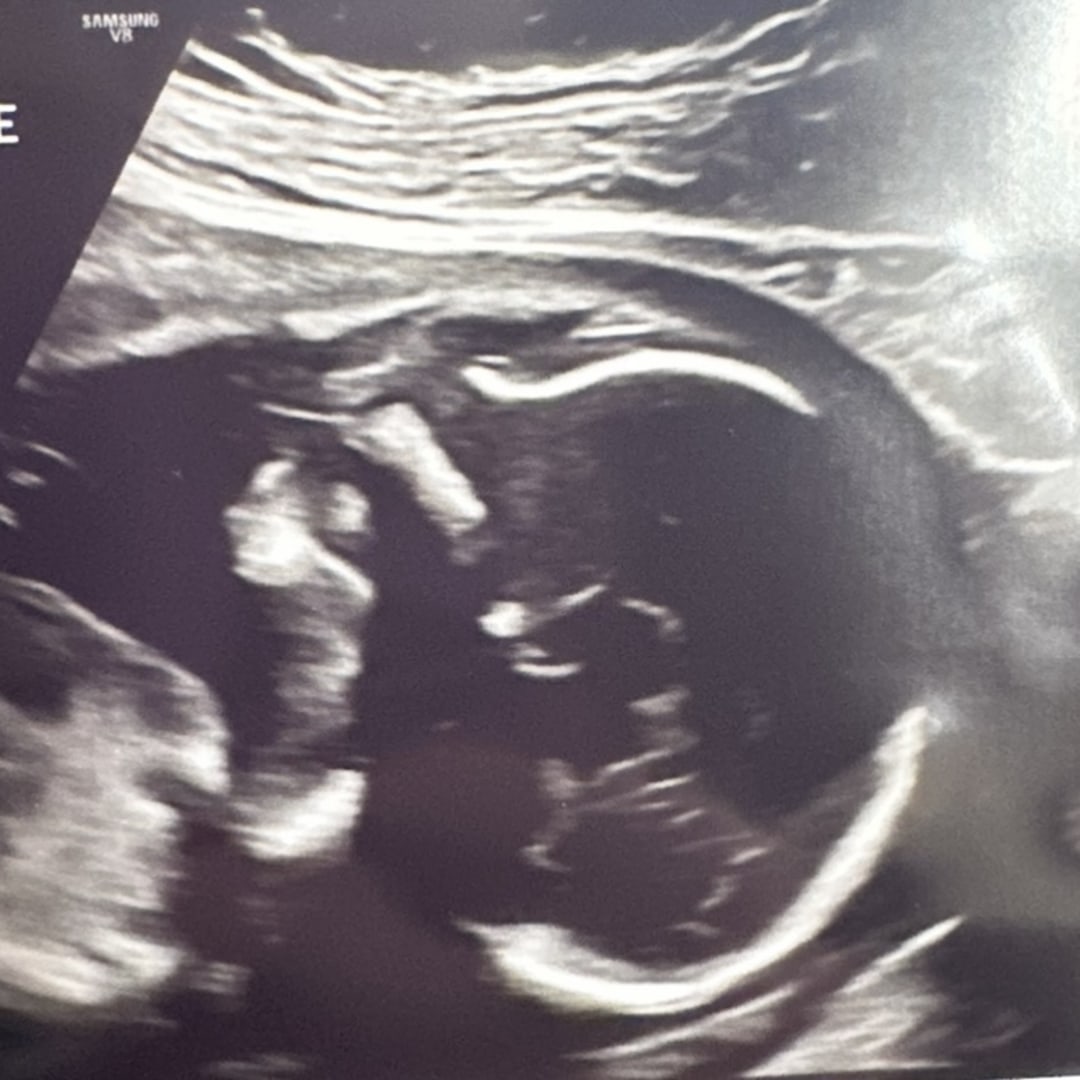 Photo shared by Ally for their Babylist baby registry.