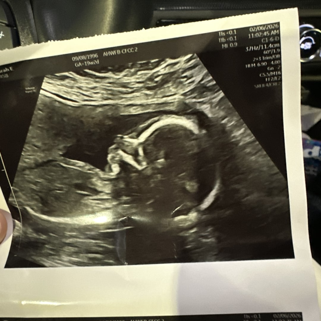 Photo shared by Sarah for their Babylist baby registry.