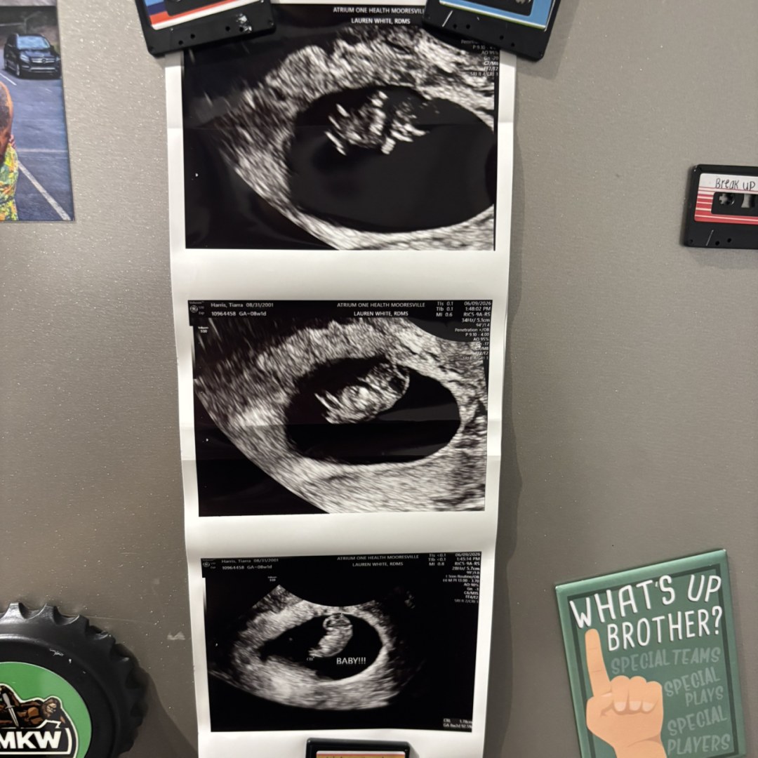 Photo shared by Tiarra for their Babylist baby registry.