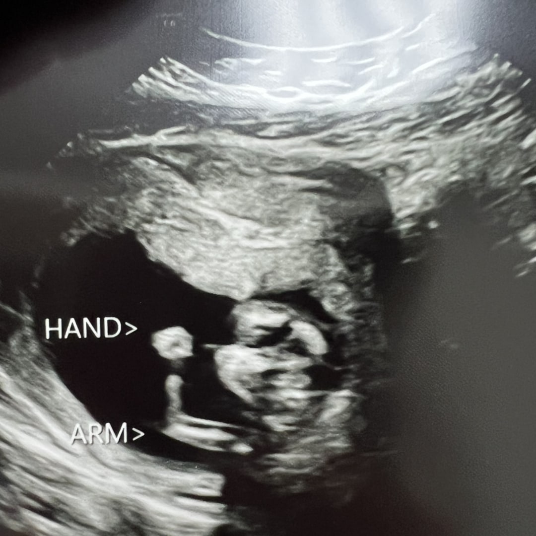 Photo shared by Bailey for their Babylist baby registry.