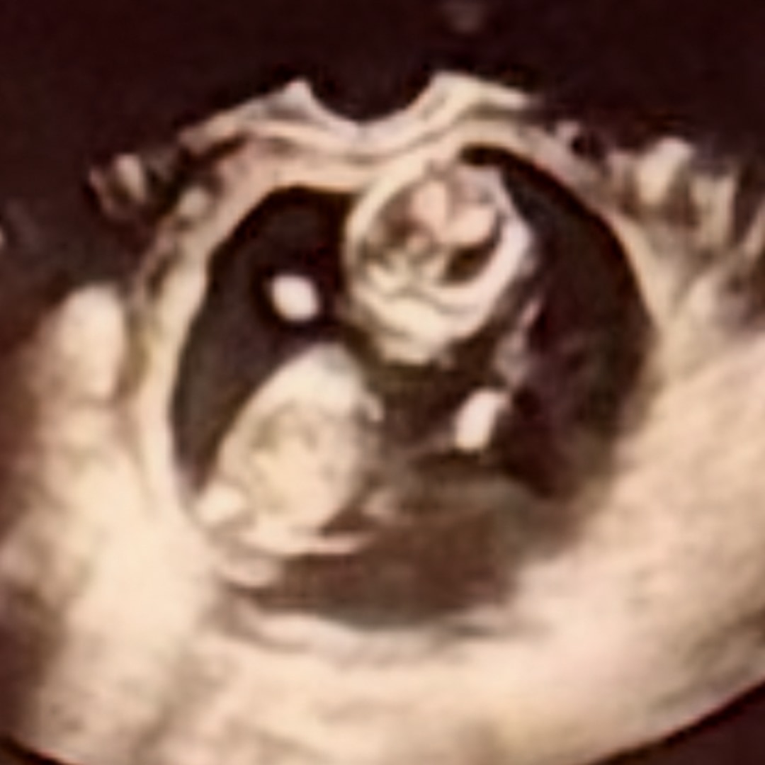 Photo shared by Jay for their Babylist baby registry.