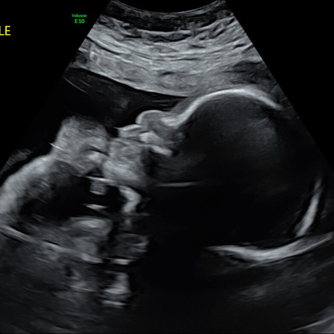 Photo shared by Brittany for their Babylist baby registry.
