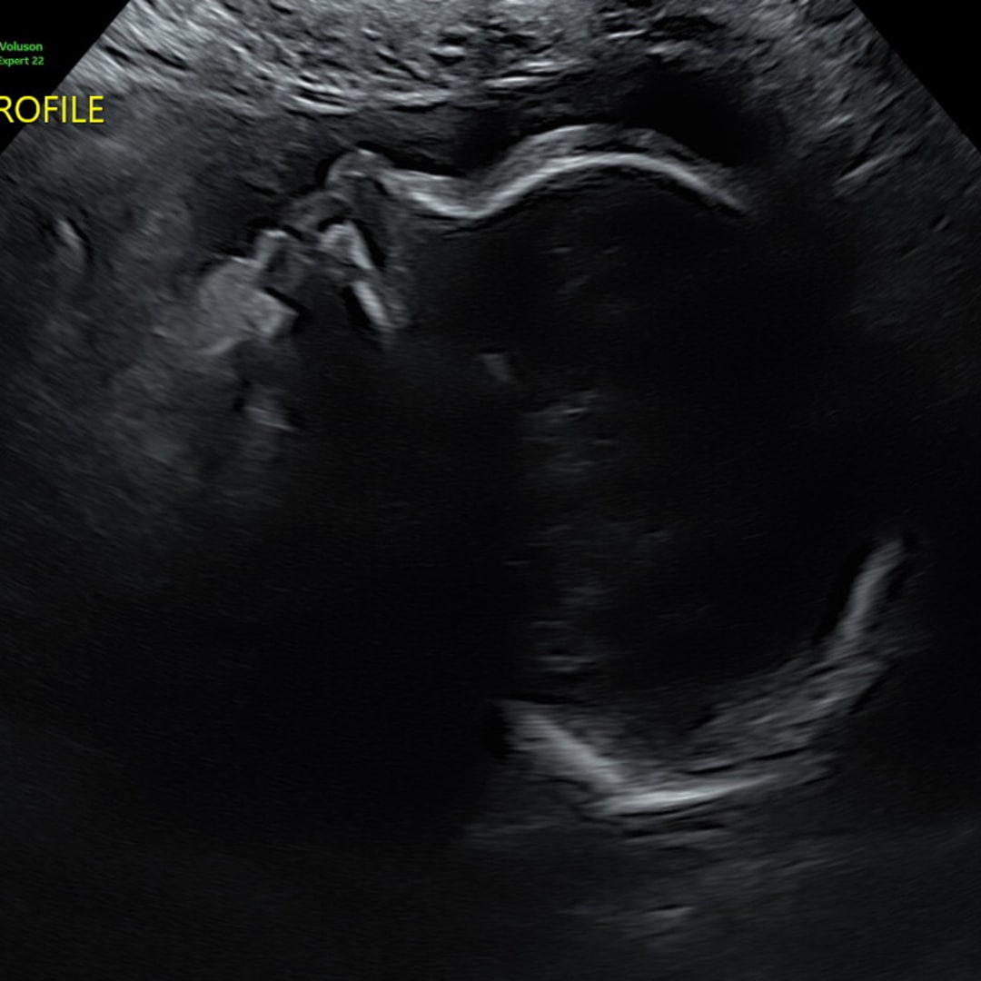 Photo shared by Doria for their Babylist baby registry.