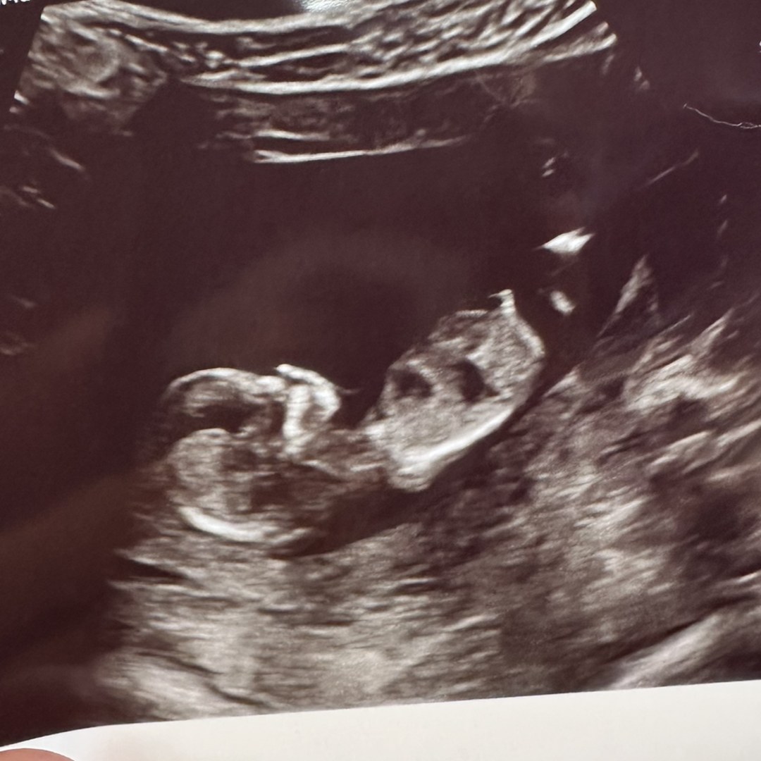 Photo shared by Autumn for their Babylist baby registry.
