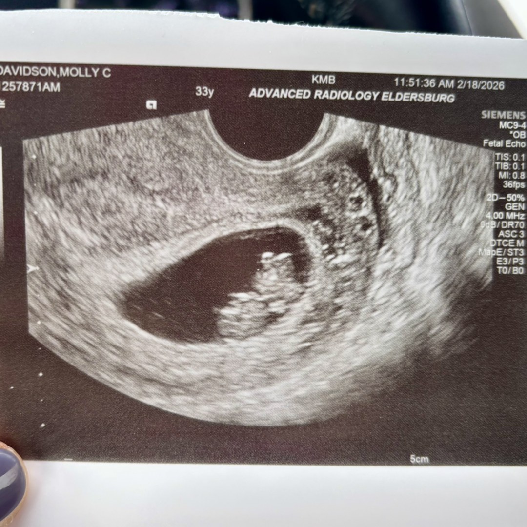 Photo shared by Molly for their Babylist baby registry.