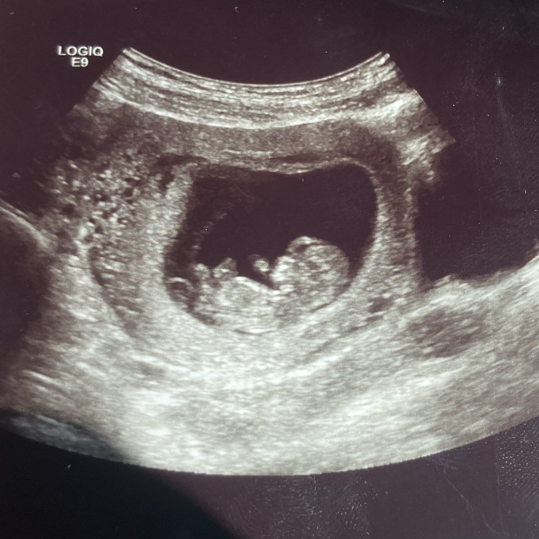 Photo shared by Aleigha for their Babylist baby registry.