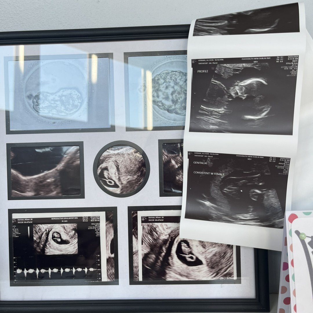 Photo shared by Allison for their Babylist baby registry.