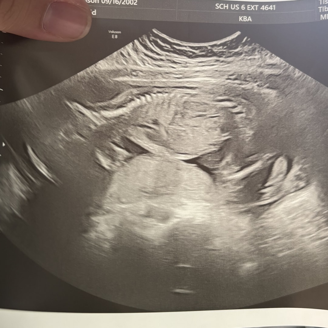 Photo shared by Maggie for their Babylist baby registry.