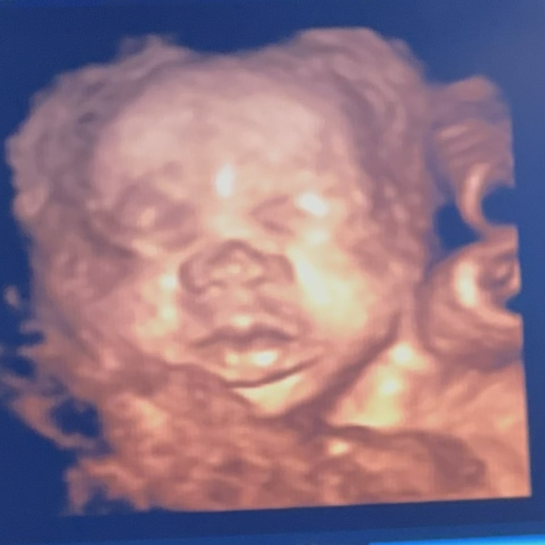 Photo shared by Cavanna for their Babylist baby registry.