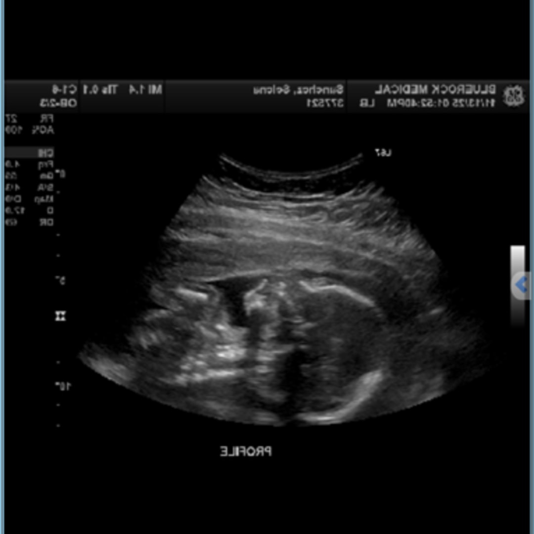 Photo shared by Favian for their Babylist baby registry.