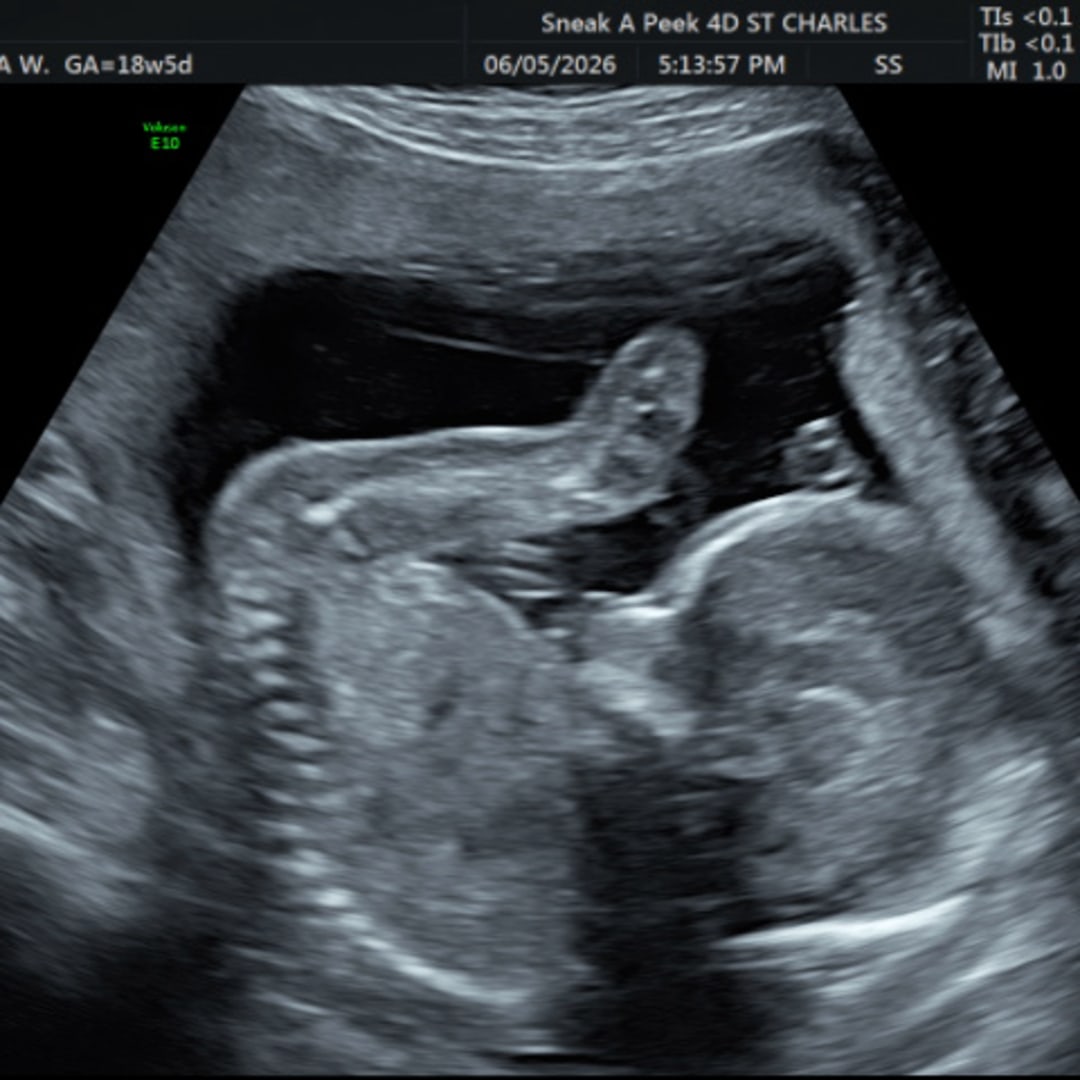 Photo shared by Alaina Osia for their Babylist baby registry.