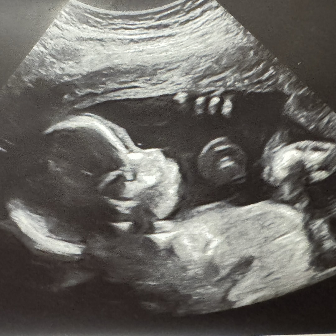 Photo shared by Arlene for their Babylist baby registry.