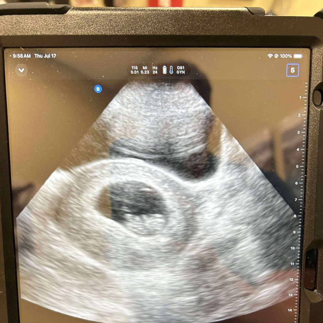 Photo shared by Isabel for their Babylist baby registry.