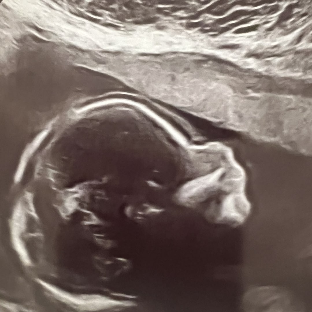 Photo shared by Brittany for their Babylist baby registry.