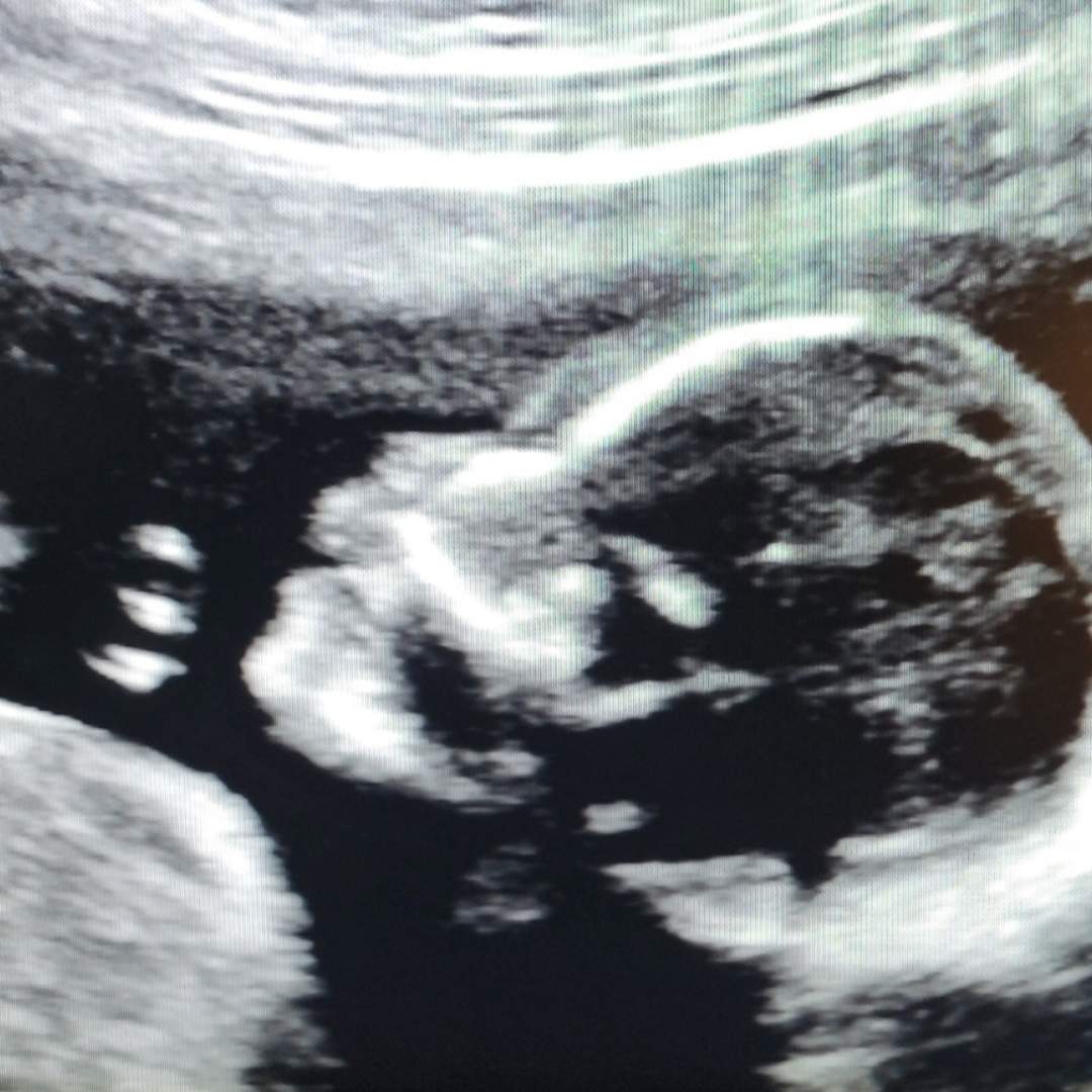 Photo shared by Myranda for their Babylist baby registry.