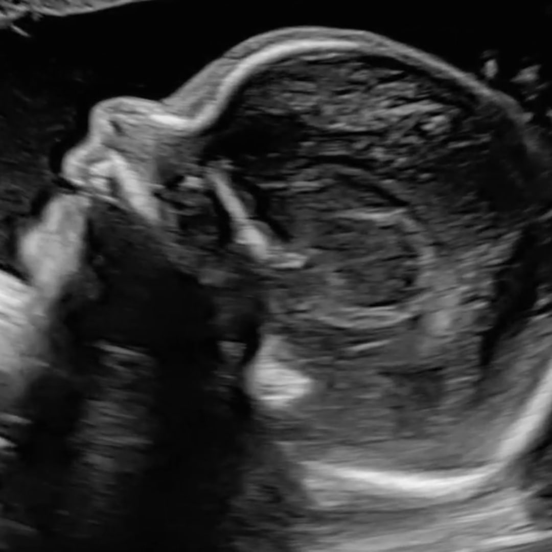 Photo shared by Ana Sofia for their Babylist baby registry.