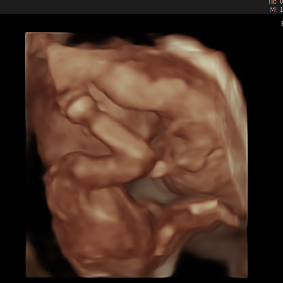 Photo shared by Keren for their Babylist baby registry.