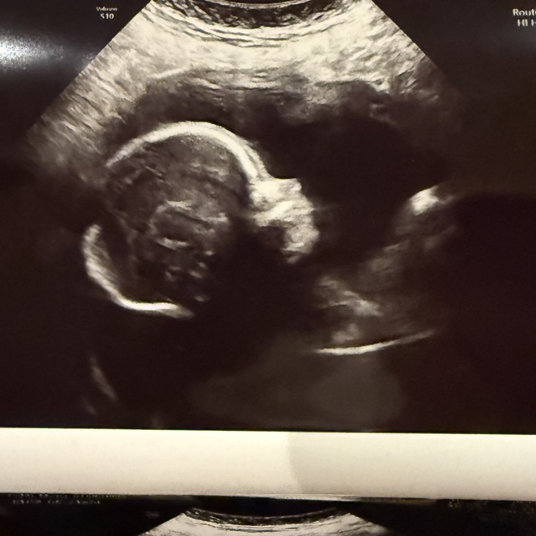 Photo shared by Mexia for their Babylist baby registry.