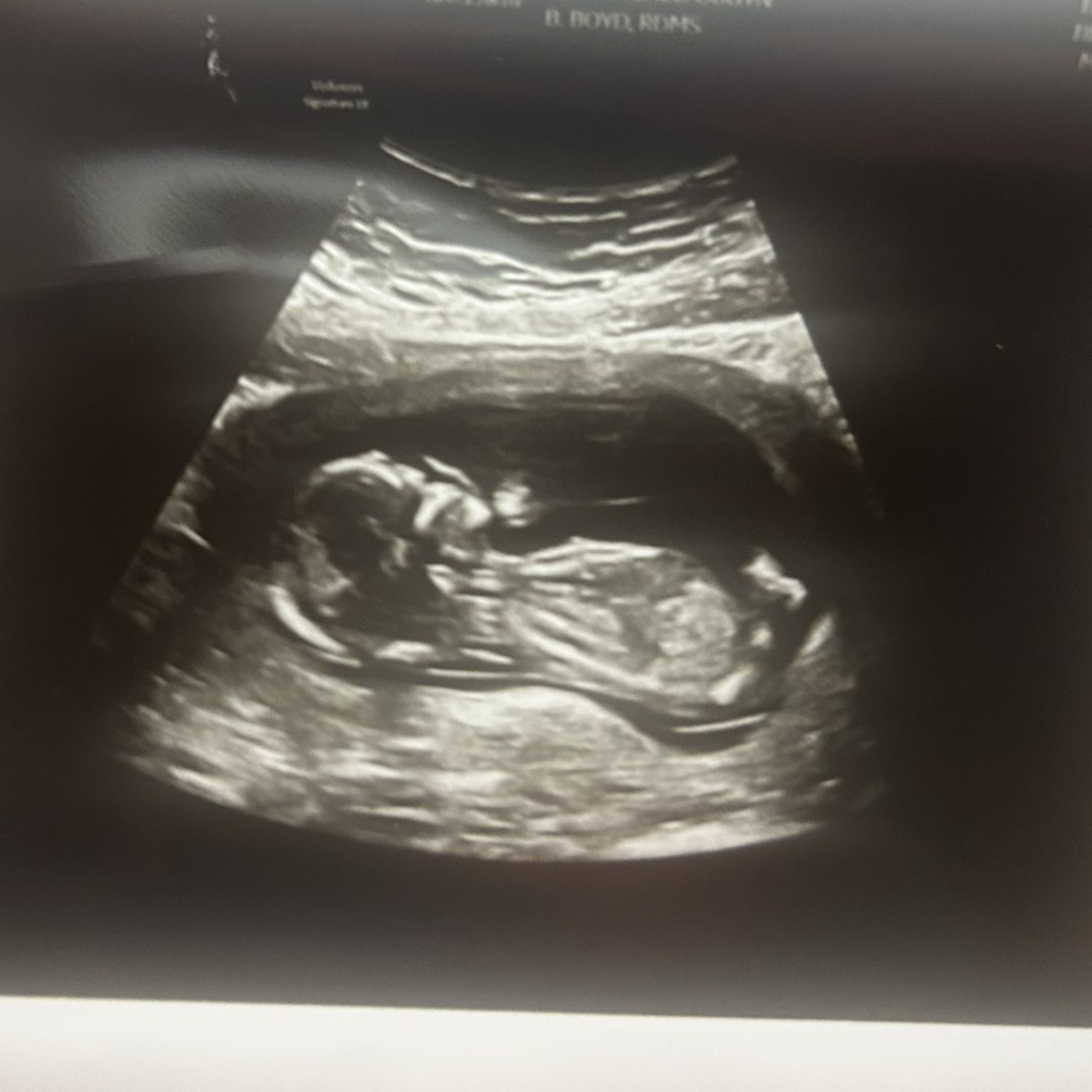 Photo shared by Ciarra for their Babylist baby registry.