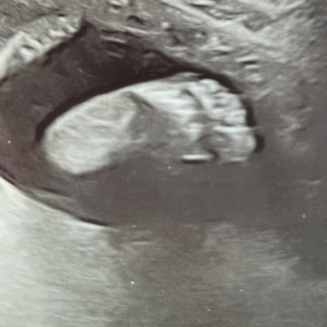 Photo shared by Joanna for their Babylist baby registry.