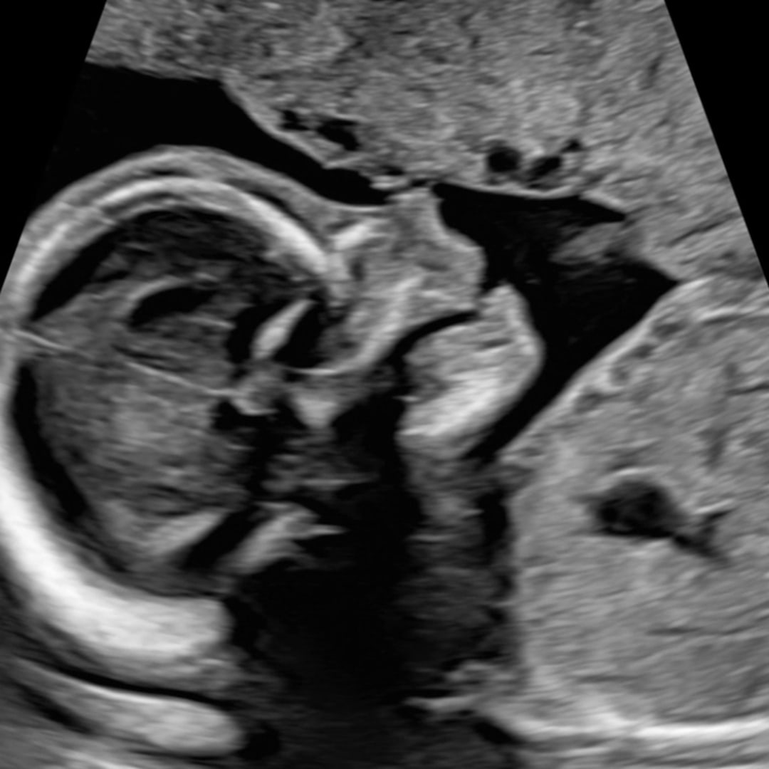 Photo shared by Carly for their Babylist baby registry.