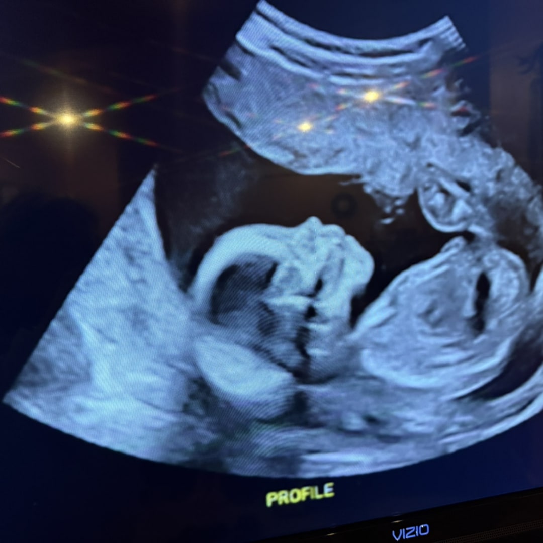 Photo shared by Alice for their Babylist baby registry.