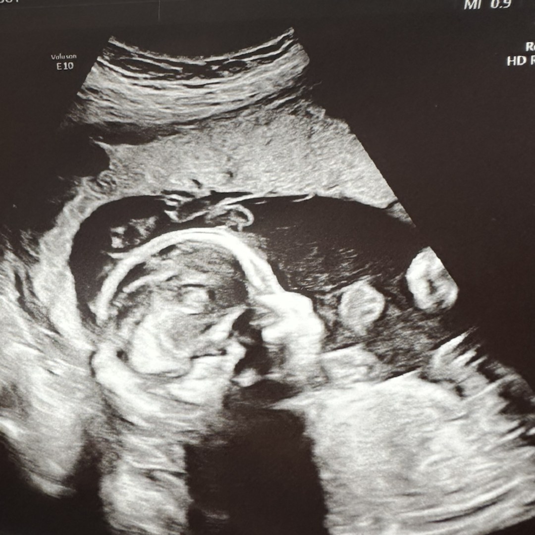 Photo shared by Molly for their Babylist baby registry.
