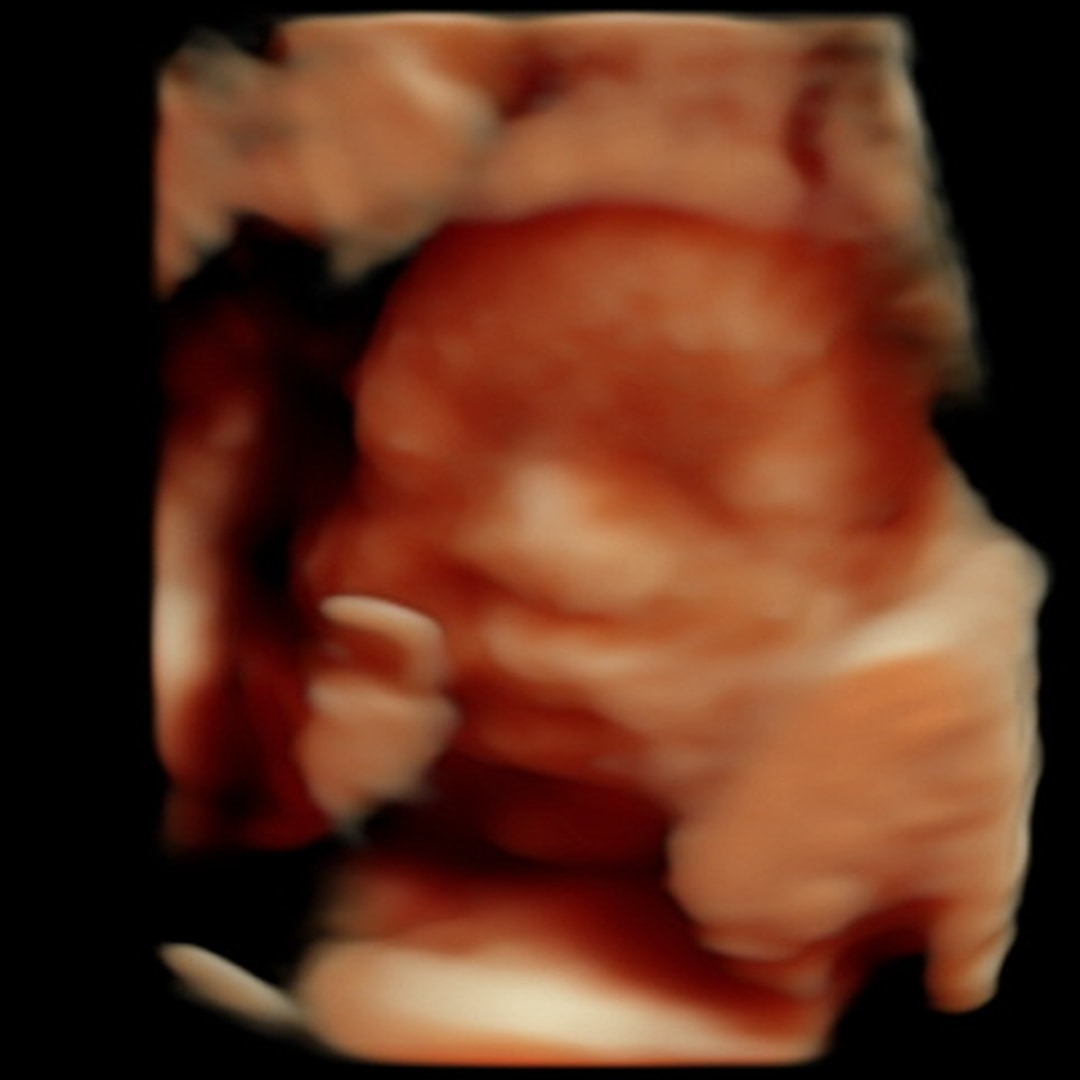 Photo shared by Adelyn for their Babylist baby registry.