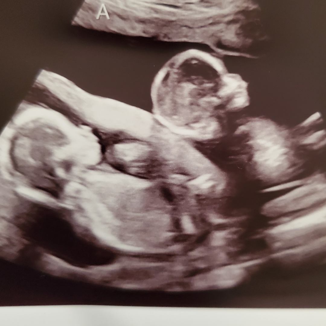 Photo shared by Carrie for their Babylist baby registry.