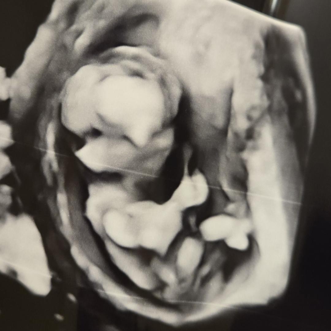 Photo shared by Ana for their Babylist baby registry.