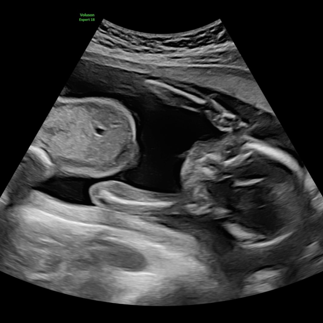 Photo shared by Scarlett for their Babylist baby registry.