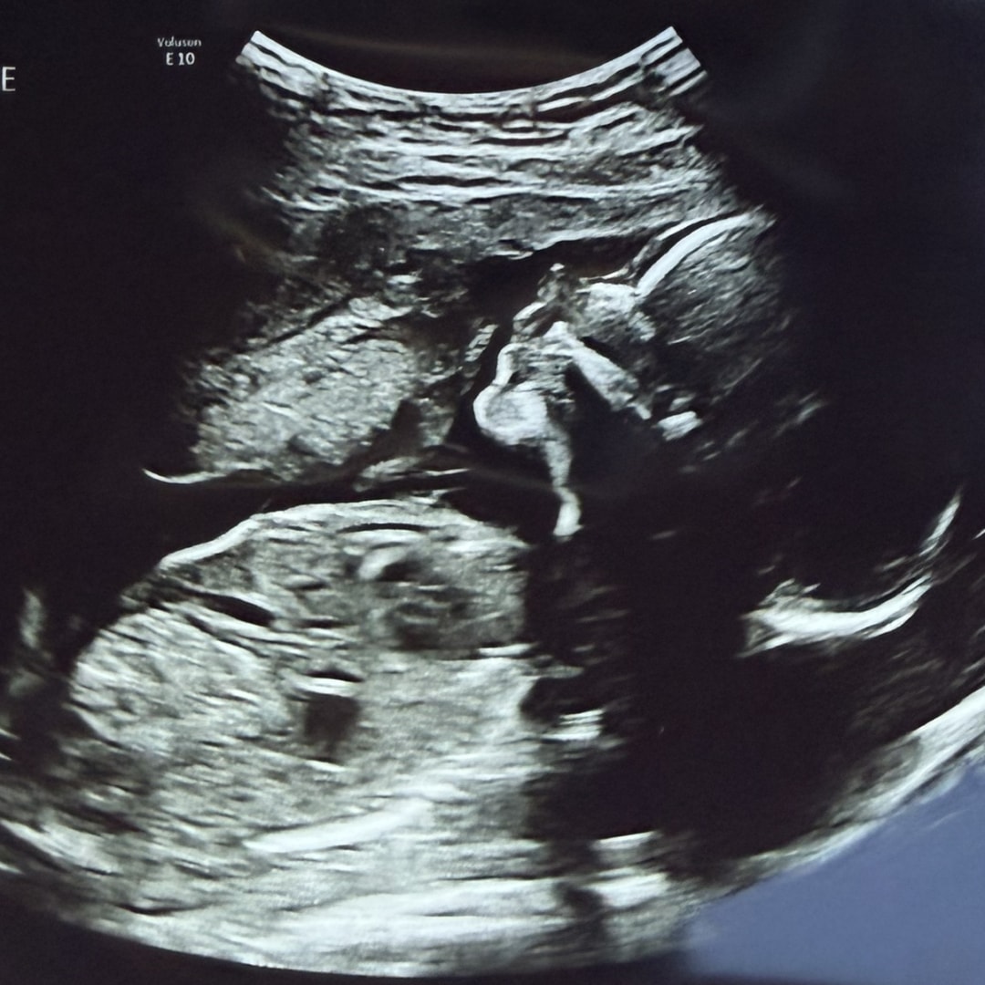 Photo shared by Ellie for their Babylist baby registry.