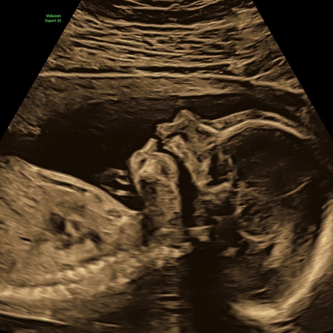 Photo shared by Casey for their Babylist baby registry.