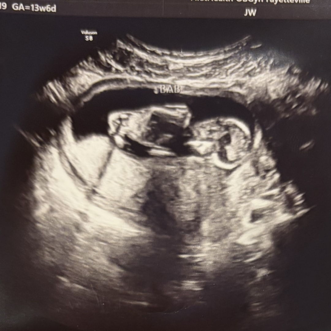 Photo shared by Isabelle for their Babylist baby registry.