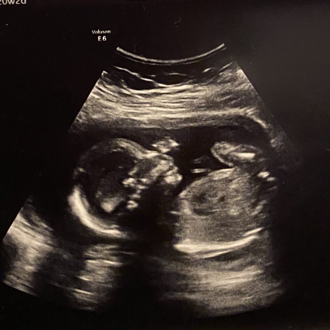 Photo shared by Rebekah for their Babylist baby registry.