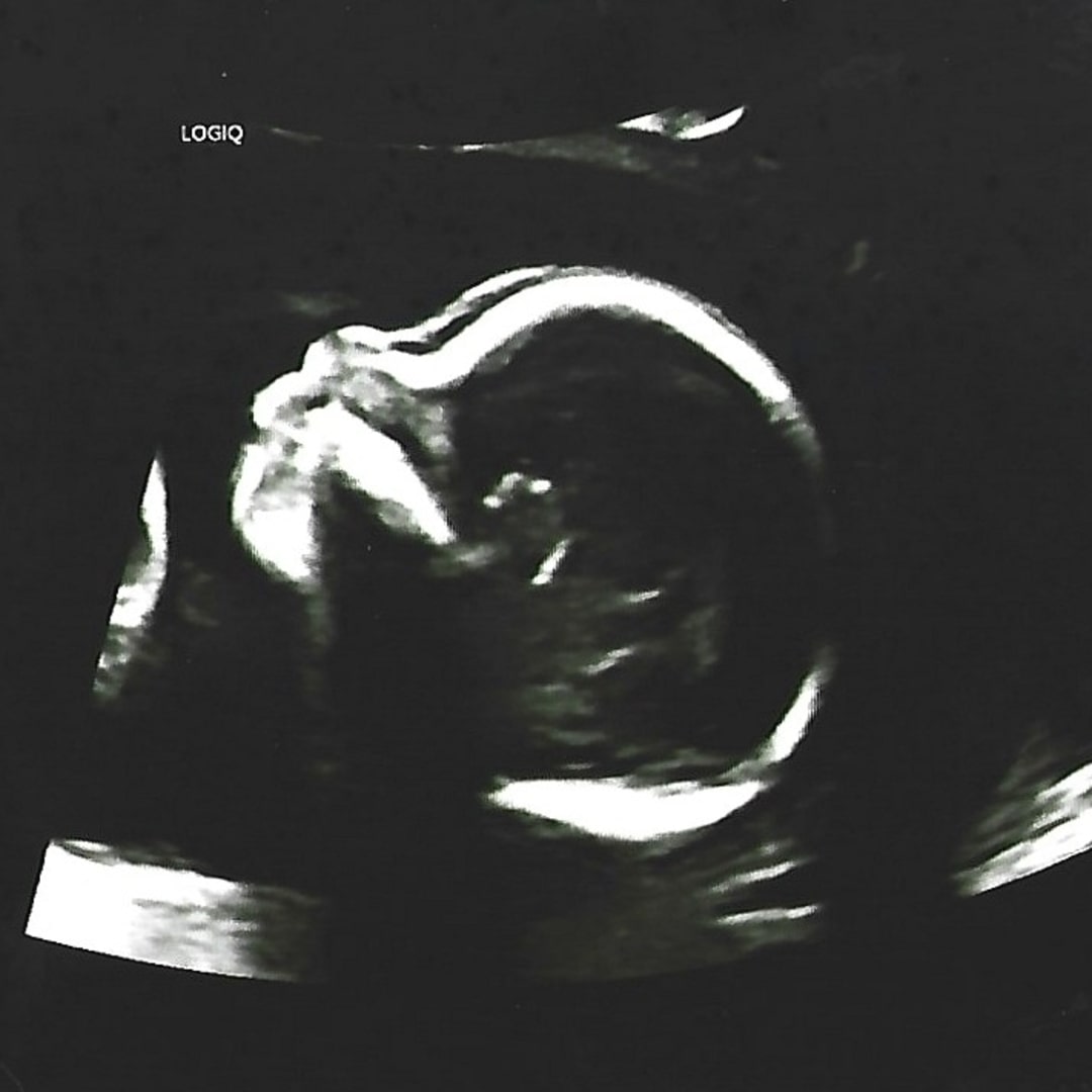 Photo shared by Heidi for their Babylist baby registry.