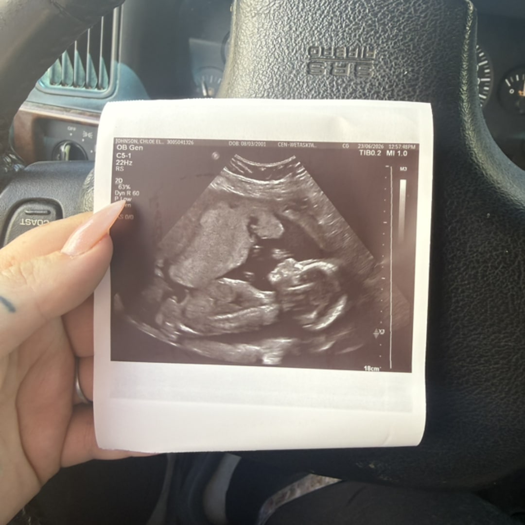 Photo shared by Chloe for their Babylist baby registry.