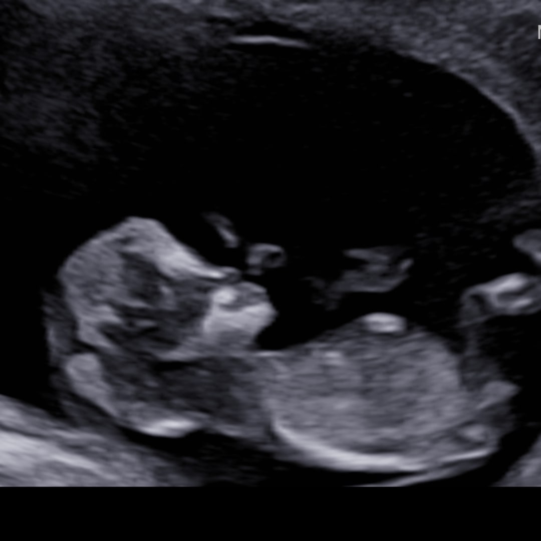 Photo shared by Chyann for their Babylist baby registry.