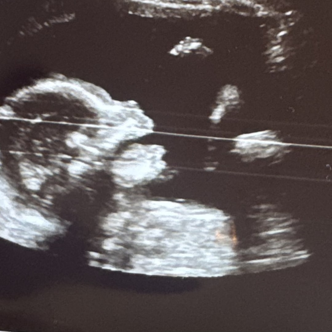 Photo shared by Athenie for their Babylist baby registry.