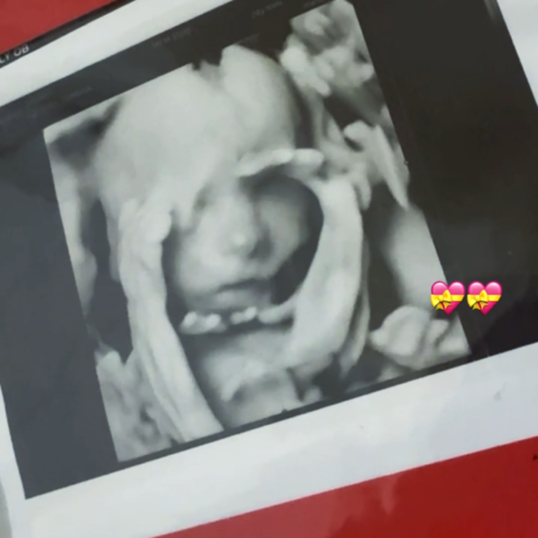 Photo shared by Sabrina for their Babylist baby registry.