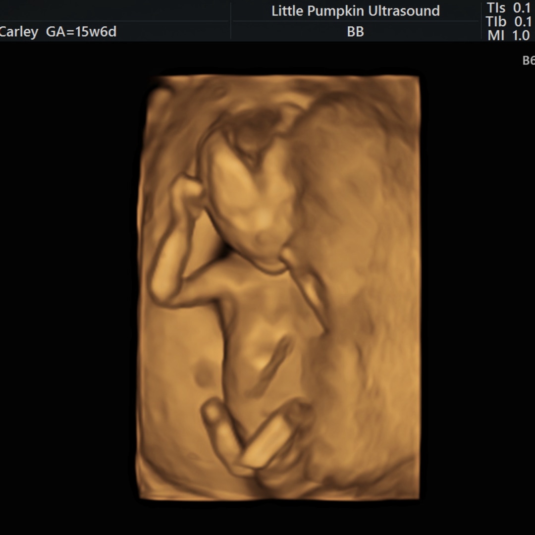 Photo shared by Carley for their Babylist baby registry.