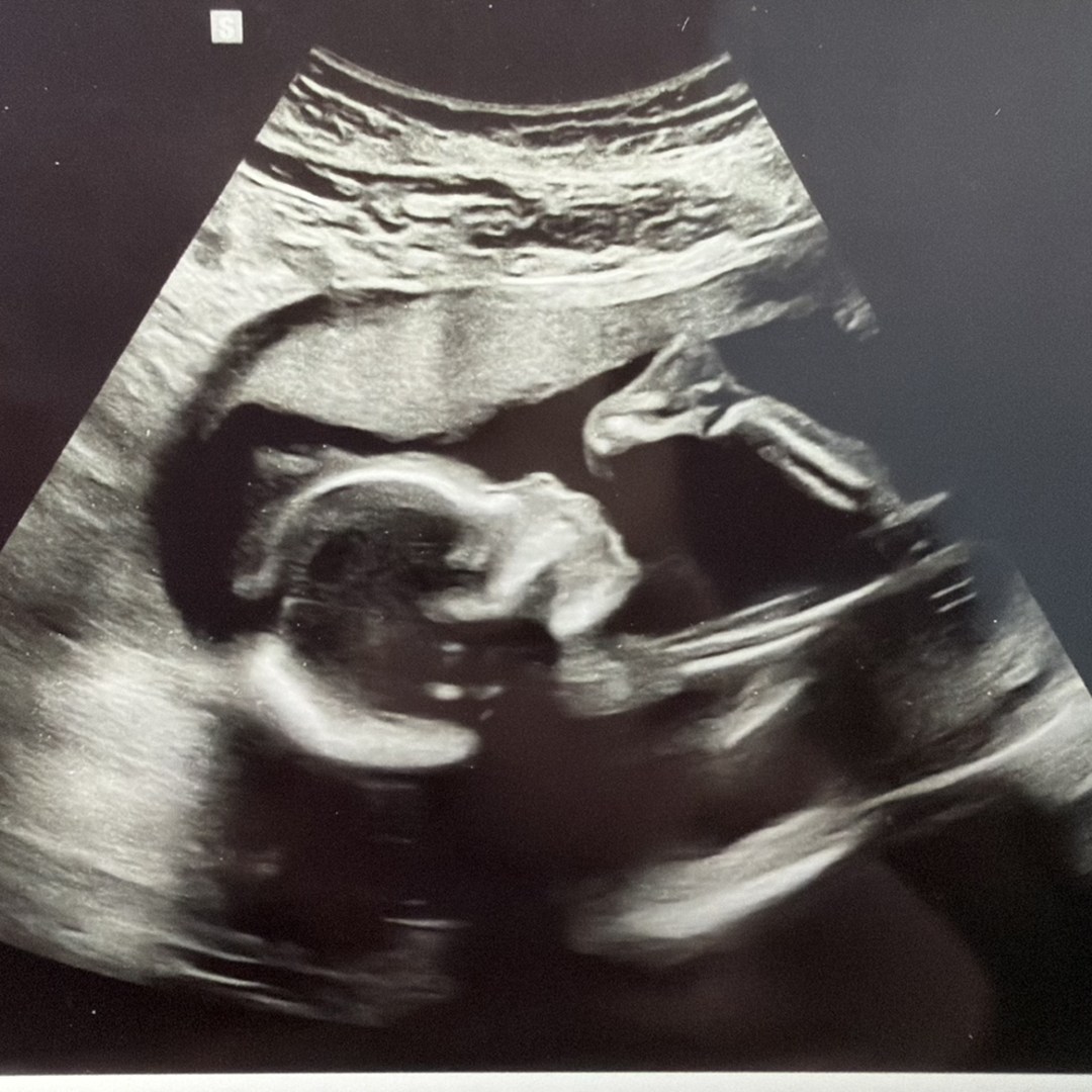 Photo shared by Caitlan for their Babylist baby registry.
